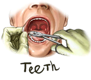 teeth
